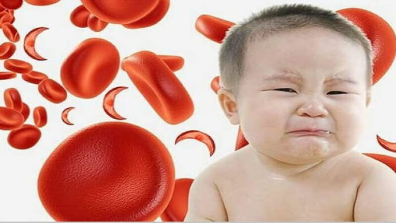 Thiếu máu não ở trẻ em do nhiều nguyên nhân gây nên