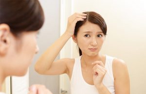 Rối loạn nội tiết tố gây rụng tóc